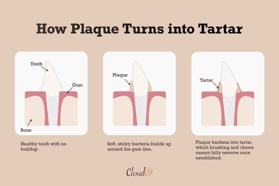Diagram showing how plaque builds up on a dog's tooth and hardens into tartar over time